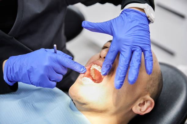 Best Emergency Wisdom Teeth Removal in Horicon, WI