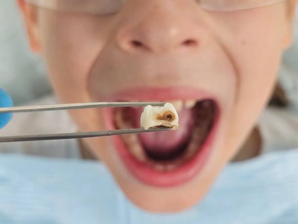 Best Pediatric Emergency Dentist in Horicon, WI