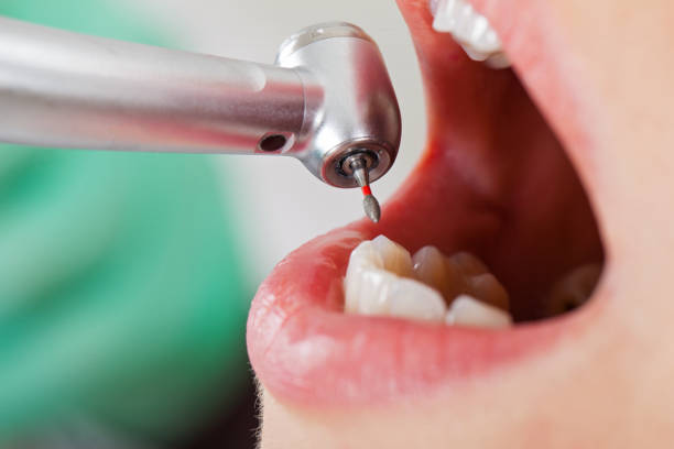 Best Emergency Treatment for Dental Infections or Abscesses in Horicon, WI